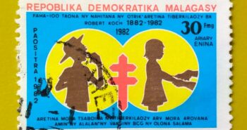 Issue:        Republic Malagasy the Discovery of the Tuberculosis Bacterium 1988 Stamp Type:         Stamp Number of Stamps:         1 Denominations:           30 FMG,  6 ariary, Issue Date:           1988 Issued By:       Madagascar Post 